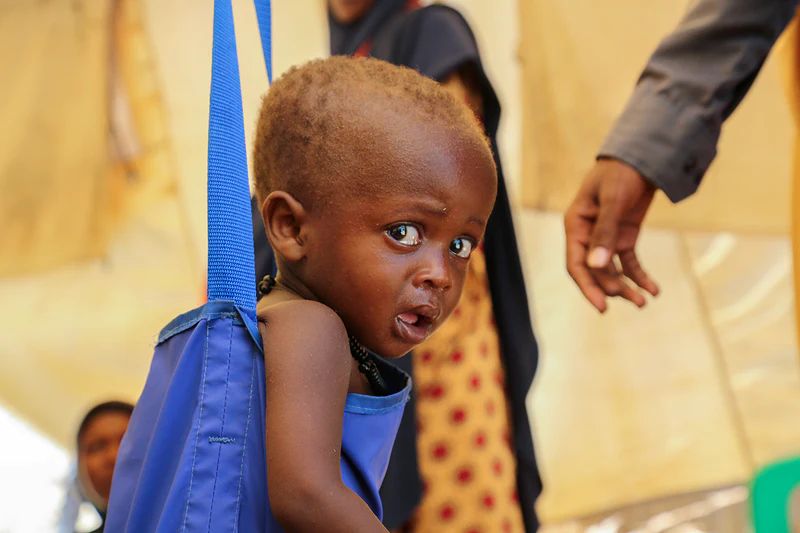 Read more about the article The Battle of Severe Acute Malnutrition In Nigeria